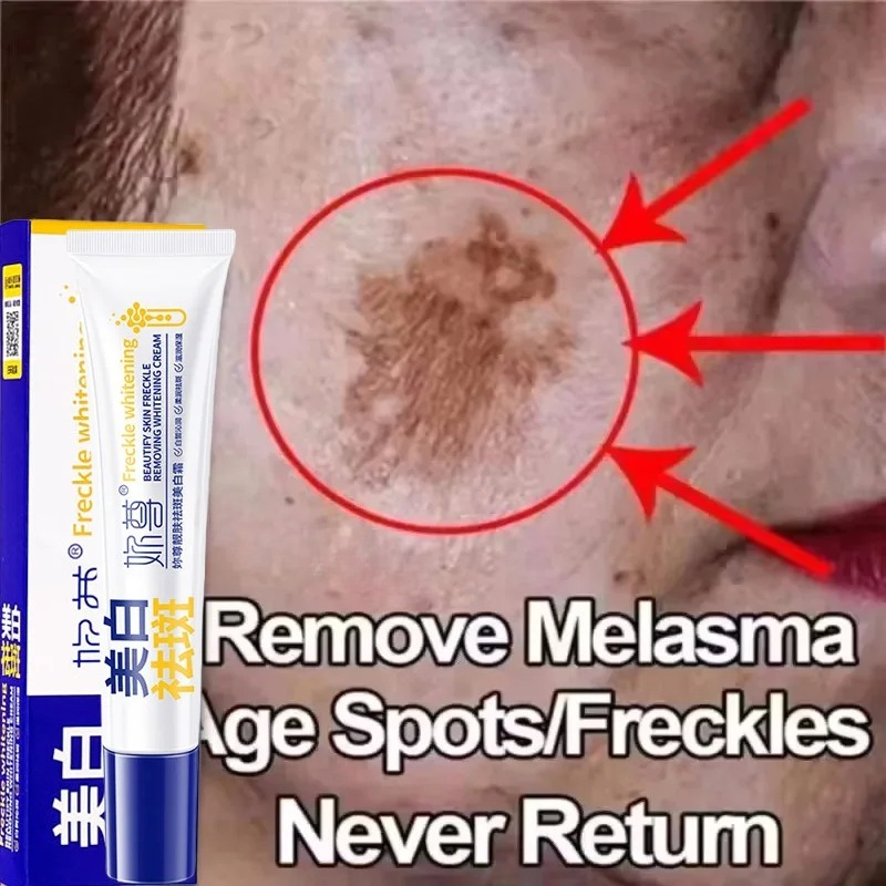Skincare Korea - Powerful Spot-Removing Whiten Cream Brighten Skin
