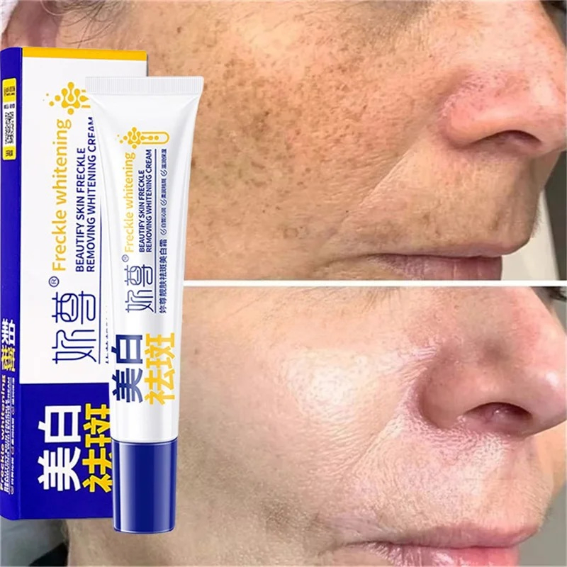 Powerful Spot-Removing Whiten  - Skincare Korea recension och pris