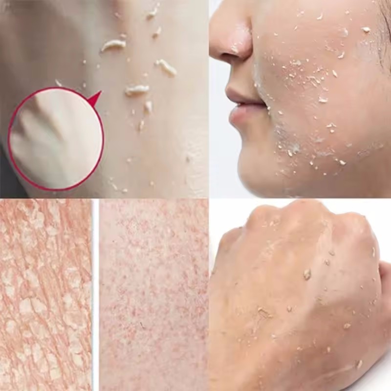 Orange Exfoliating Peeling Gel - Ceramide Moisturizer recension och pris
