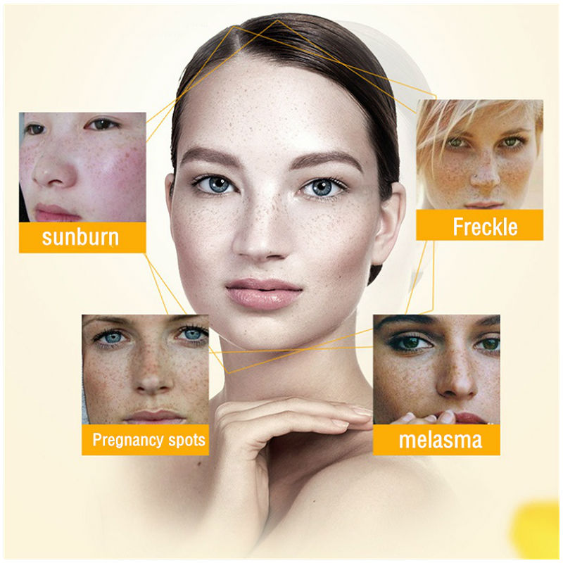 Dimollaure Whitening Freckle C - Skincare Korea recension och pris