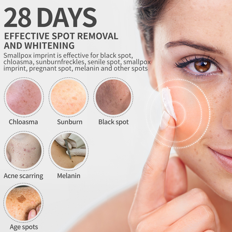 Dimollaure Whitening Freckle C - Skincare Korea recension och pris